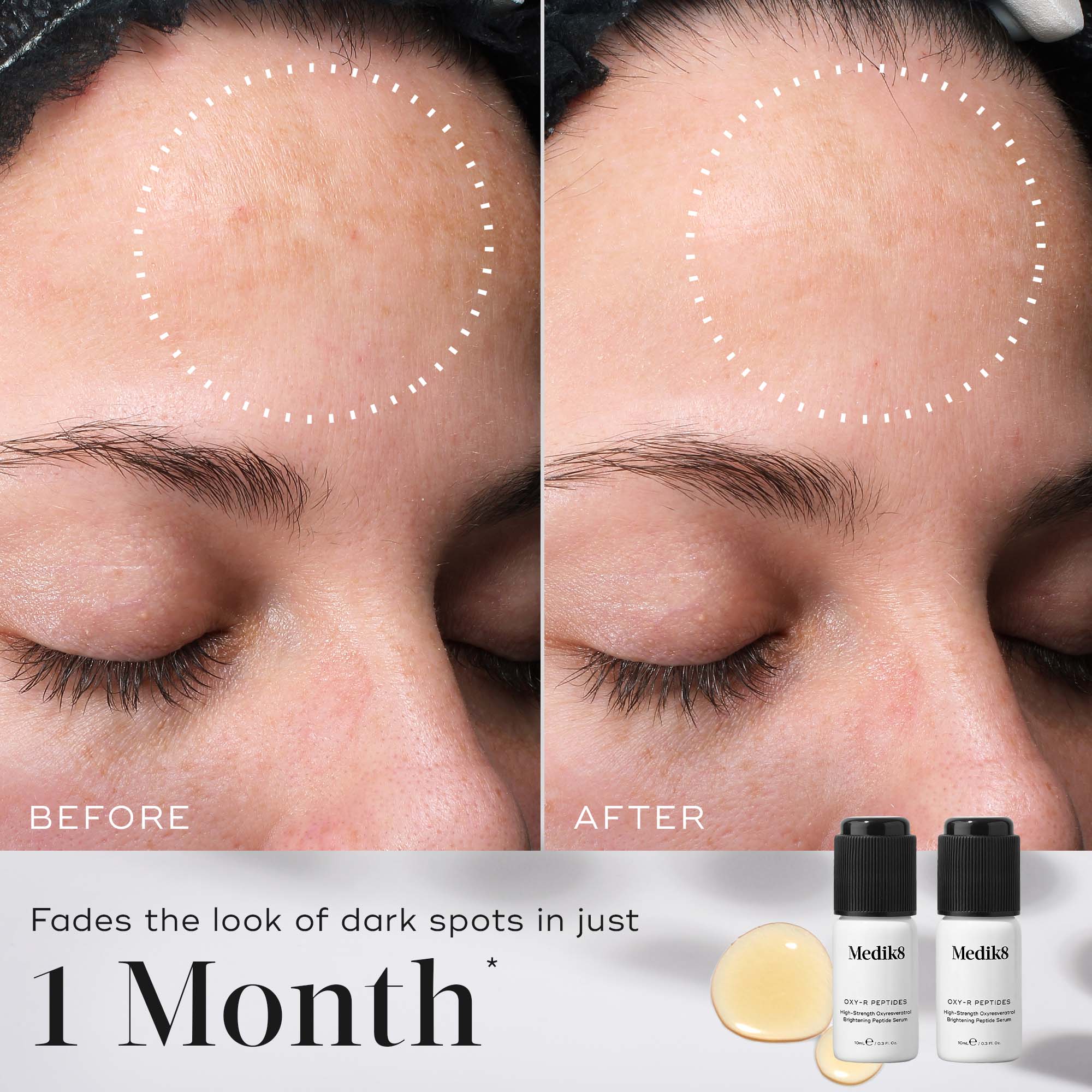 Medik8 Oxy-R Peptides - Before and After