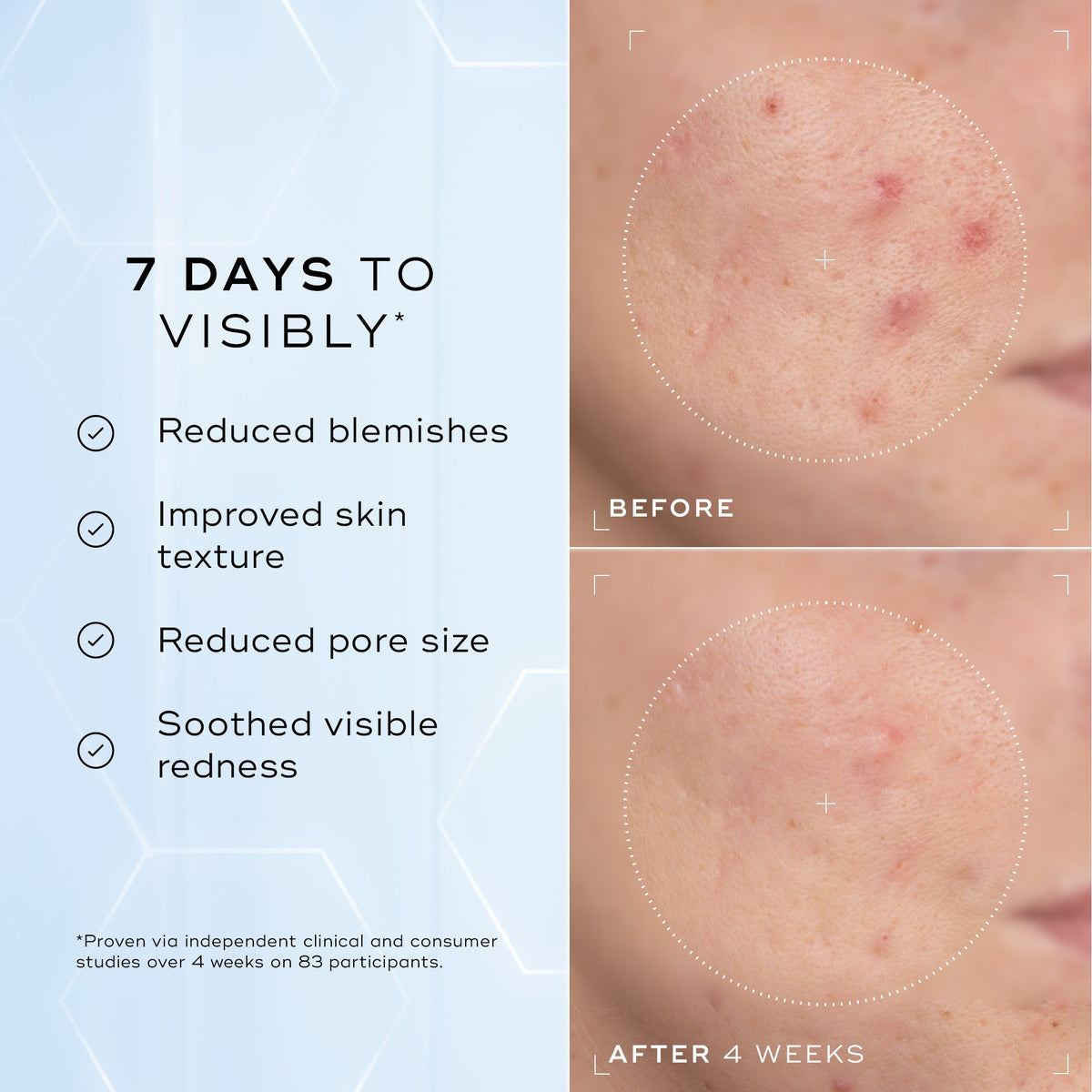 Medik8 Niacinamide Peptides - Carousel Asset 2