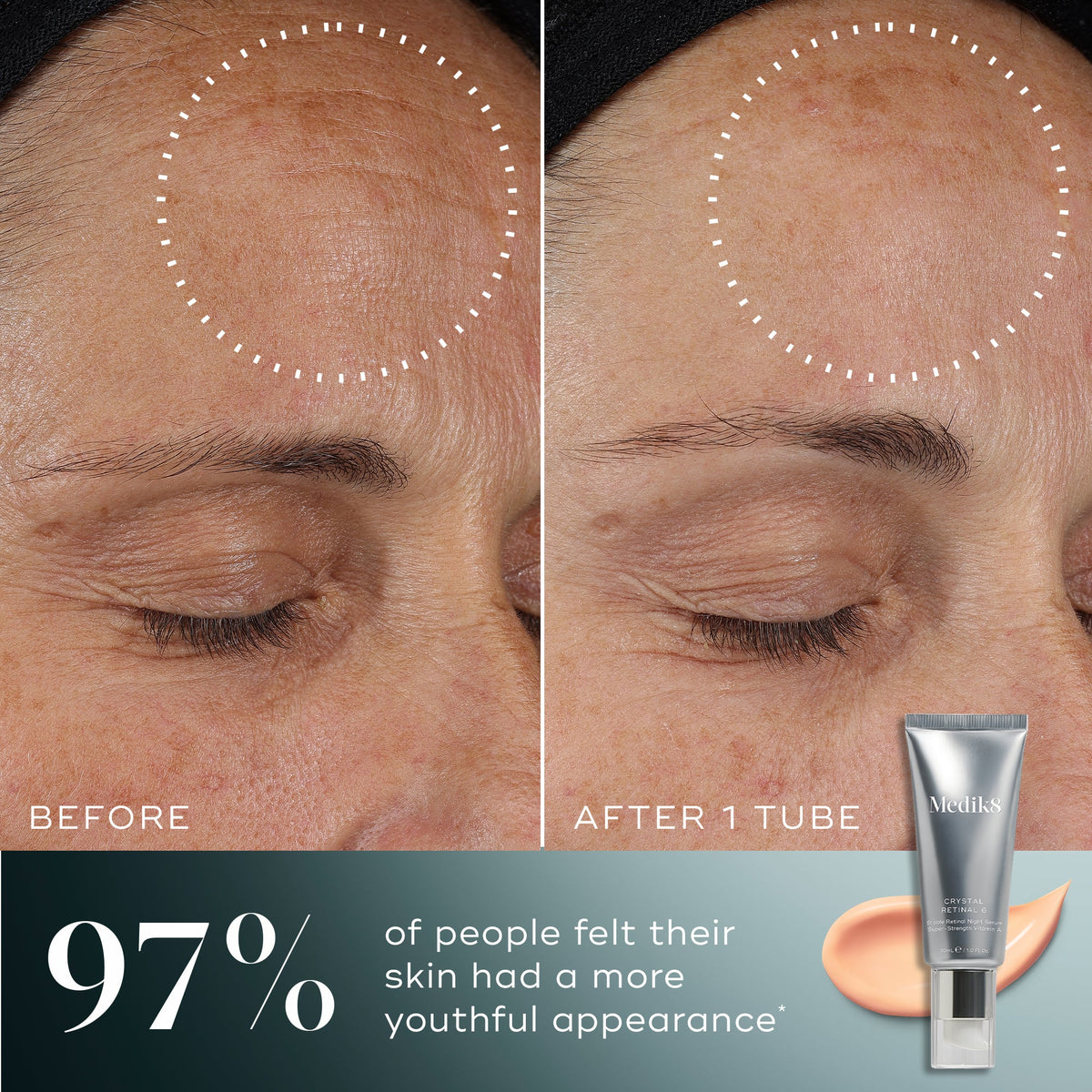 Medik8 Crystal Retinal Before and After