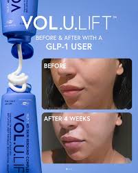 VOL.U.LIFT