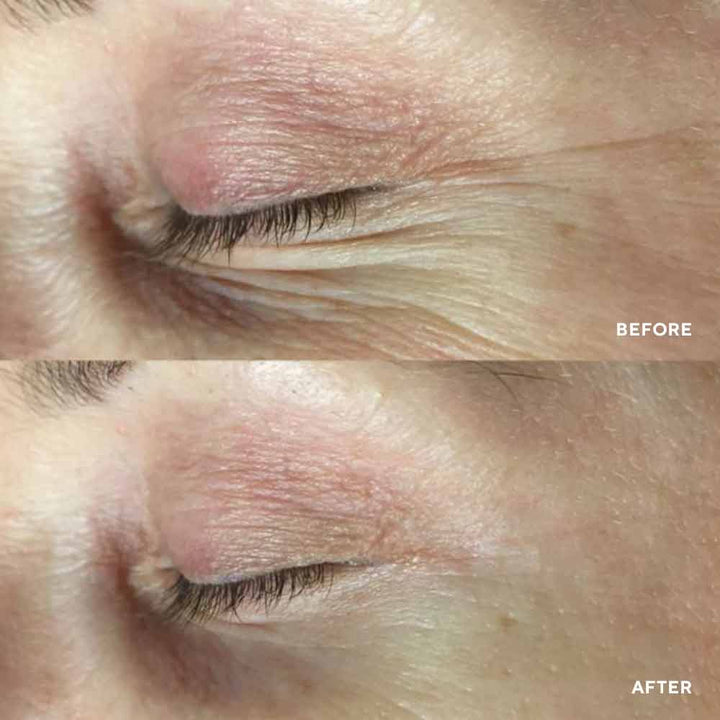 Hydropeptide PolyPeptide Collagel Eye