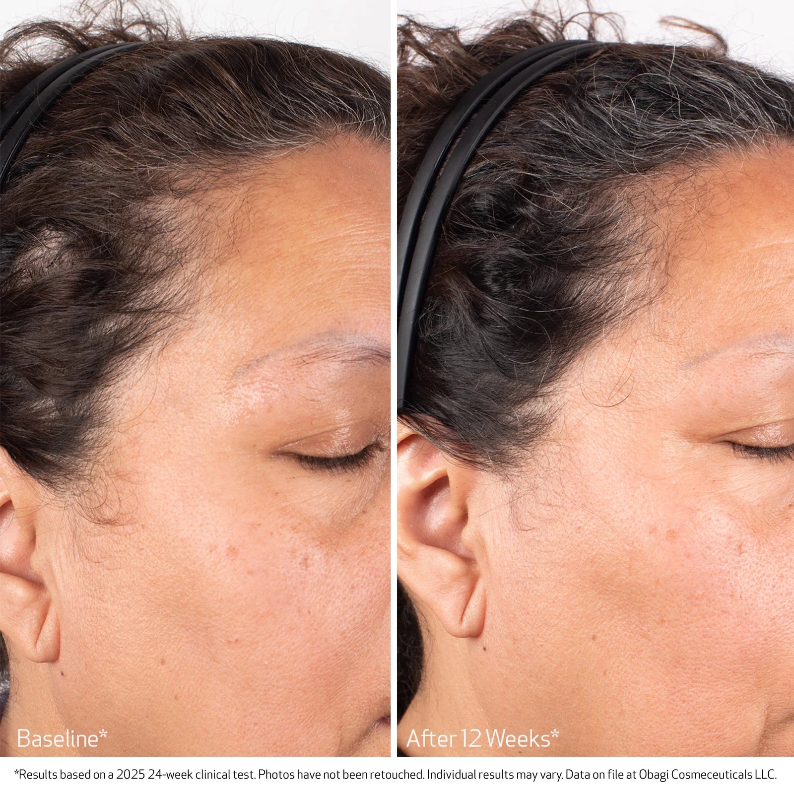 OBAGI NU-CIL® BIOSTIM™ SCALP SERUM