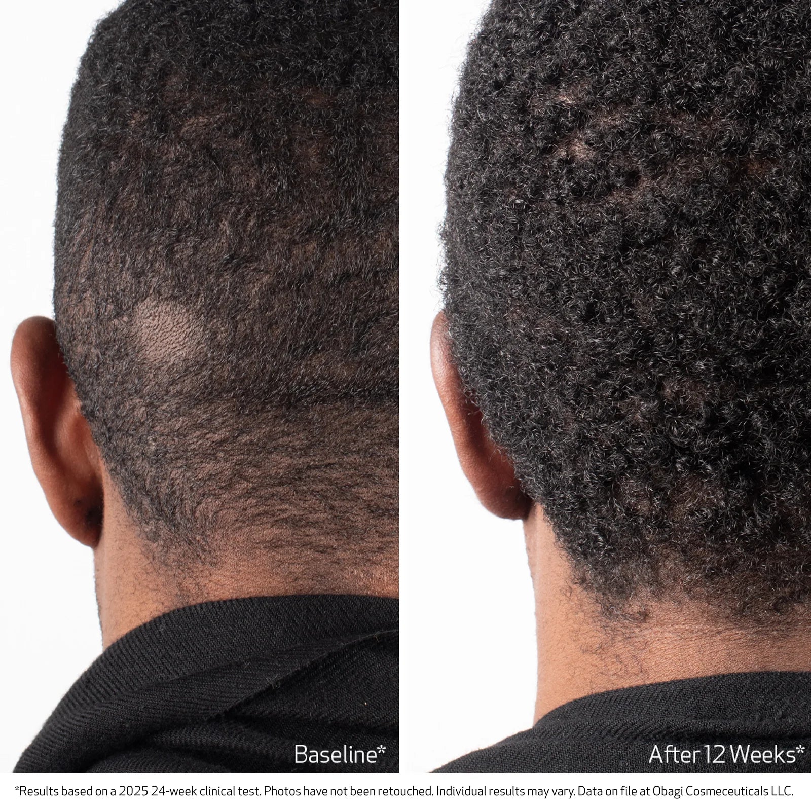 OBAGI NU-CIL® BIOSTIM™ SCALP SERUM