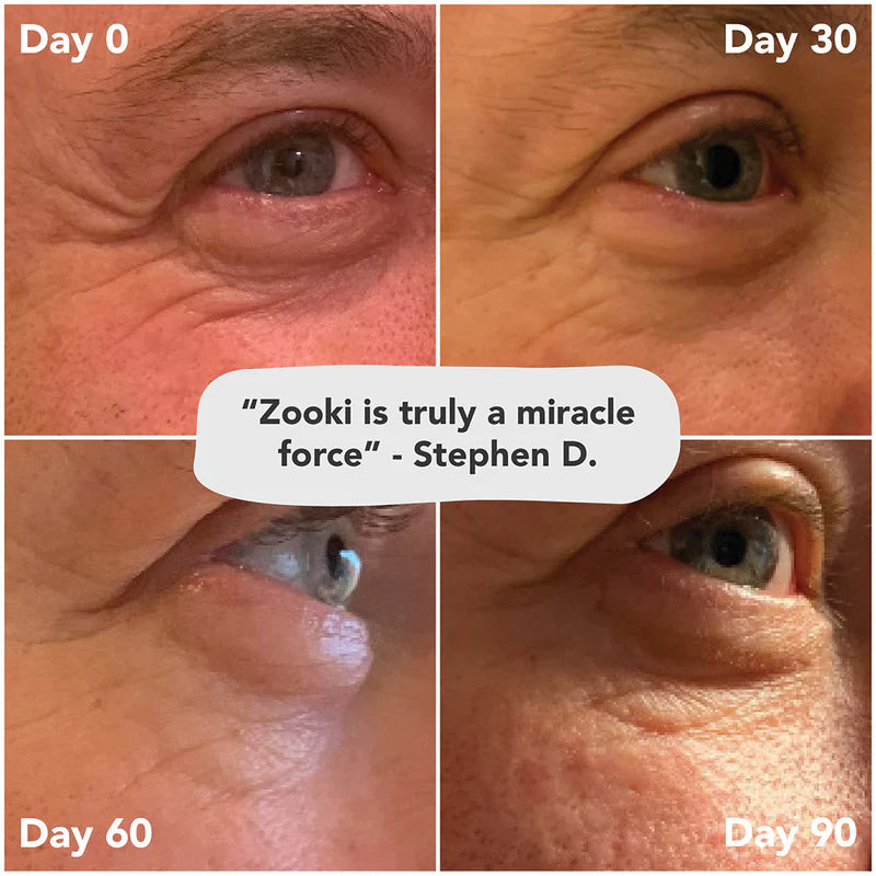 Zooki Super Strength Marine Collagen 11,000mg, Sour Cherry Flavour - 30x18.5ml Liquid Sachets